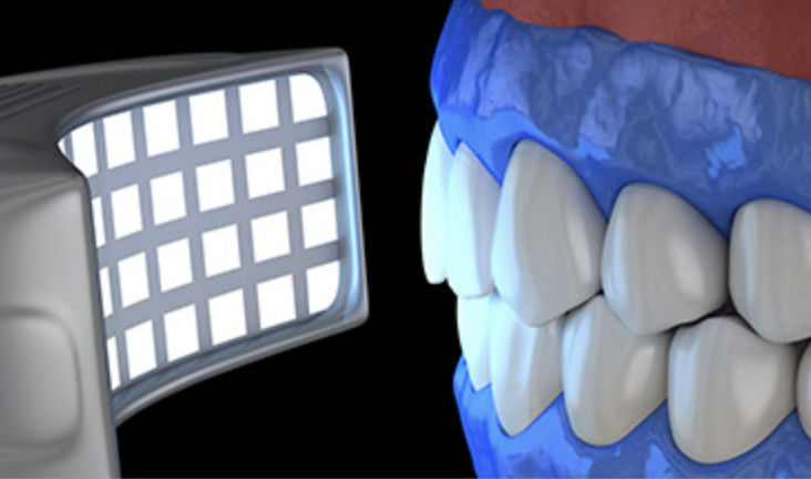 Step 05 - 청색 미백 광선 조사